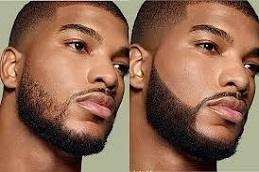 Results of Beard Micropigmentation before & After clinic in Dubai