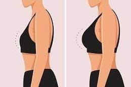 Results of Breast Lift Surgery before & After clinic in Dubai