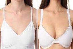 Results of Breast Lift Surgery clinic in Dubai
