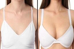 Results of Breast Reconstruction clinic Dubai