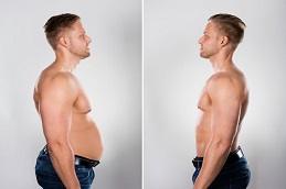 Results of Tirzee Injection in Dubai