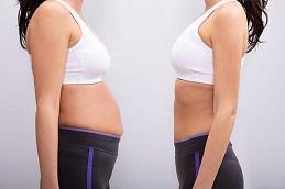 Tirzee Injections before & After clinic in Dubai