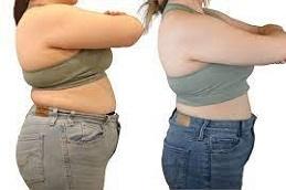 Tirzee Injections before & After clinic
