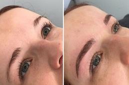 Microblading before & After clnic Dubai