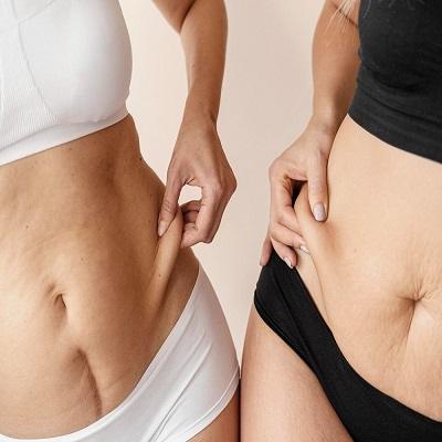 BodyTite Liposuction Cost in Dubai & Abu Dhabi
