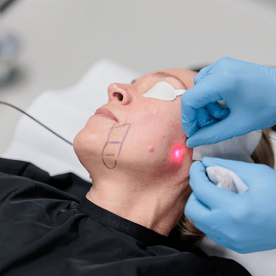 Endolift Surgery in Dubai & Abu Dhabi