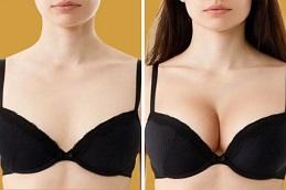 How to Choose the Right Breast Augmentation Implants Before & After Dubai