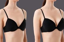 How to Choose the Right Breast Augmentation Implants Before & After