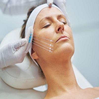 Thread Lift Treatment Cost in Dubai & Abu Dhabi