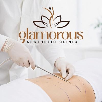 Best Liposuction in Dubai & Abu Dhabi