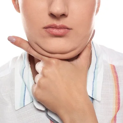 Double Chin Removal Cost in Dubai & Abu Dhabi