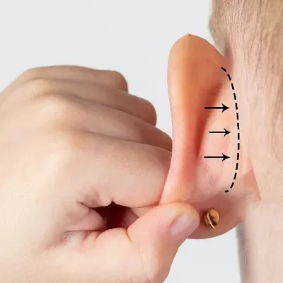 Earlobe Correction Surgery Cost in Dubai & Abu Dhabi
