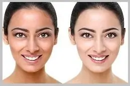 Results OF Liposomal Glutathione Injections Dubai,