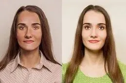 Results OF Liposomal Glutathione Injections clinic in Dubai