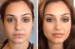 Results OF Liposomal Glutathione Injections in Dubai UAE