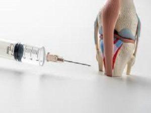 kness injection before & bAfter in Dubai