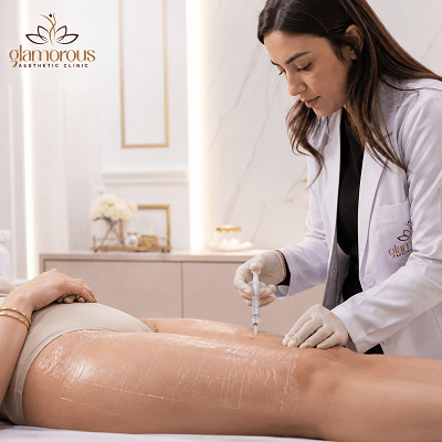 Sculptra Treatment for Body Dubai & Abu Dhabi