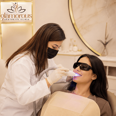 Dental Stains Removal Dubai & Abu Dhabi