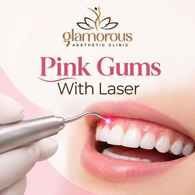 Pink Gums With Laser Dubai & Abu Dhabi