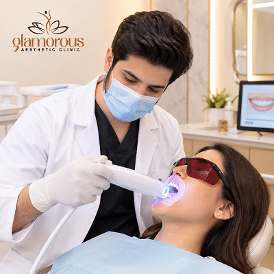 Home Teeth Whitening Dubai & Abu Dhabi