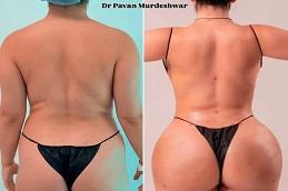 Results OF Dr. Pavan Murdeshwar Dubai