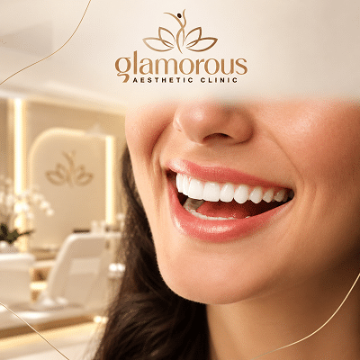 Ultra Thin Veneers Dubai & Abu Dhabi